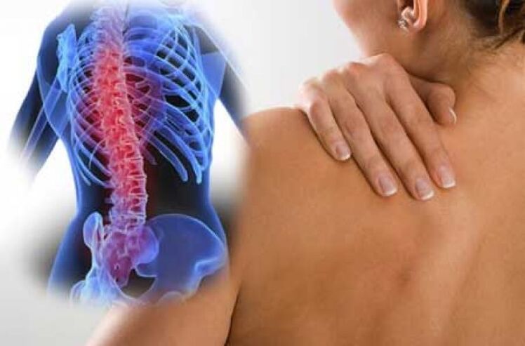 Падчас абвастрэння астэахандрозу груднога аддзела пазваночніка ўзнікаюць болі дорсага